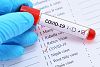 МЗ: Изискването на PCR тест за прием в болница е незаконосъобразно