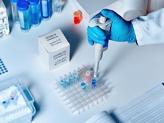 Болници искат МЗ да плаща PCR тестовете при прием на пациенти