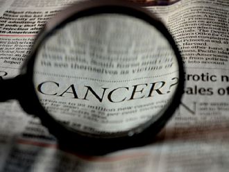 САЩ: Поради COVID-19 има рязък спад в диагностиката и лечението на рака на дебелото черво  