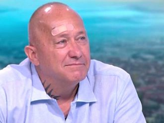 Д-р Дончо Дончев: След COVID-19 дишам с остатъци от белите си дробове