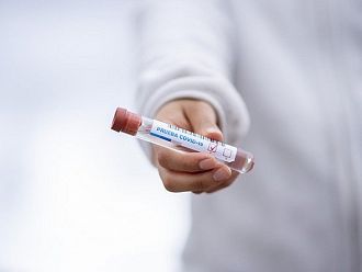 НЗОК: Няма лимити за направленията за тестовете за коронавирус