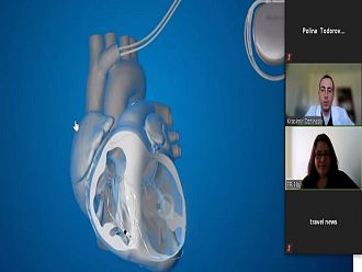 Сърдечносъдовите заболявания убиват 17 милиона души всяка година