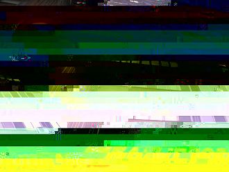 УМБАЛ - Пловдив обяви безплатни АГ прегледи