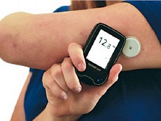 НЗОК вече реимбурсира сензорите за продължително мониториране на глюкозата