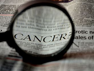 Великобритания: Близо 50 000 пациенти с рак са диагностицирани късно заради пандемията  