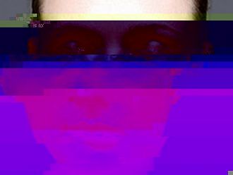 ЕК разреши първия биологичен медикамент за лечение на системен лупус