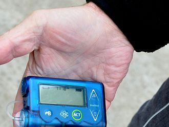 Променят критериите за кандидатстване на деца с диабет тип 1 за глюкозни сензори