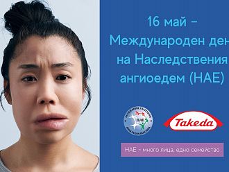 У нас има регистрирани 90 пациенти с наследствен ангиоедем, но вероятният им брой е по-голям