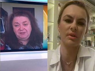 Проф. Александрова: Вирусът на маймунската шарка трудно може да предизвика пандемия като тази от COVID