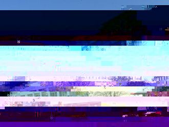 В УМБАЛ Бургас извършиха сложна ортопедична операция с ривърс раменно ендопротезиране