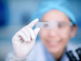 Създаден е бърз тест за определяна на C-реактивен протеин в капилярна кръв