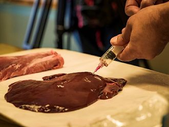 Български лекар откри иновативна модификация на биопсия, подобряваща диагностиката при тумори