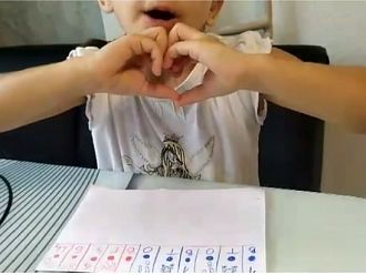 В ИСУЛ поставиха слухови импланти на двете деца на семейство от Плевен