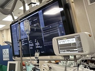 В УМБАЛ „Чирков“ имплантираха кардиовертер-дефибрилатори на шестима пациенти