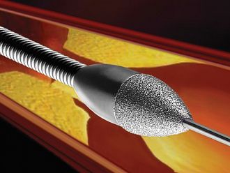 Бъбречни заболявания, диабет и тютюнопушене са главните причини за стесняване на съдовете