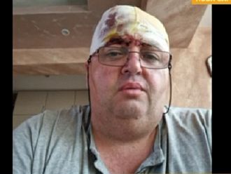 Д-р Димитров: Ако не беше катастрофата, пациентът в линейката можеше да бъде спасен