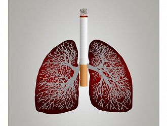 Над 4200 нови случая на рак на белия дроб годишно се диагностицират у нас