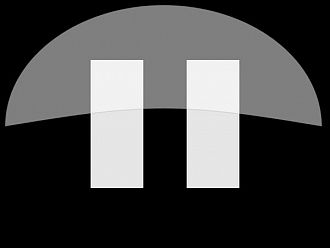 Голяма детска болница в Атина спира плановите операции заради недостиг на персонал