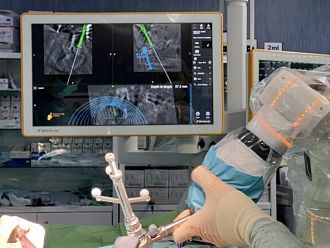 Стабилизираха гръбнака на пациентка със спондилолистеза в УМБАЛ „Св. Анна“ с робот