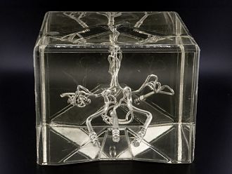 AI ще подобрява живота на оцелелите от инсулт