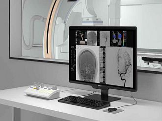 УМБАЛ Бургас ще има втора ангиографска зала