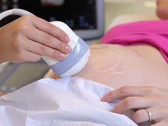 Медицинска техника с премиера в България: 5D ехограф SonoScape S50