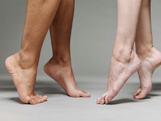 Какво трябва да знаем за разширените вени?