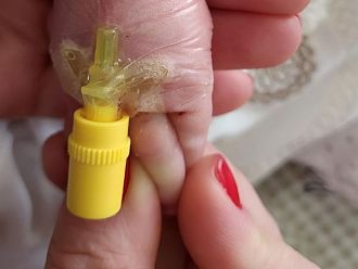 Иновация осигурява комфорт и сигурност при лечението на бебета в УМБАЛ „Лозенец“