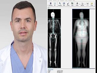Нов, по-точен метод за оценка на телесния състав и костната плътност в УМБАЛ Каспела