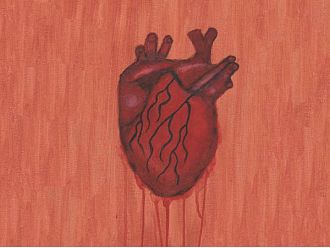 Изложба „Инфарктът“ се открива в петък