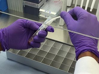 С изсушени кръвни проби и проби от орална течност ще доказват морбили и рубеола