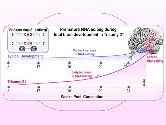 Учени от САЩ и България с откритие за различното развитие на мозъка при синдром на Даун