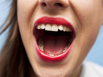 Кампания „Ако се съмняваш, провери!“, посветена на рака на устната кухина, започва във Варна