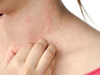 Увеличаване на кожните алергии очакват дерматолози