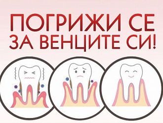 Кампанията „Погрижи се за венците си!“ организират студенти от МУ-Варна