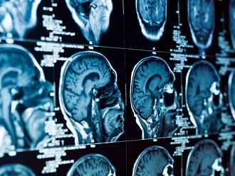 Редица нови изисквания в новия стандарт по образна диагностика