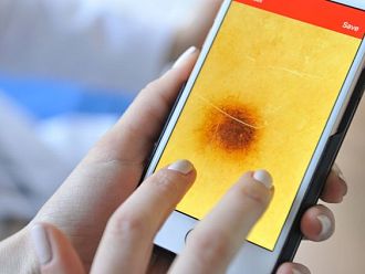 Безплатни прегледи за кожни новообразувания във ВМА