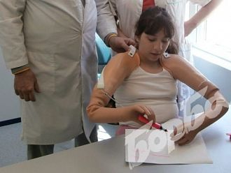 За първи път у нас е протезирано дете, родено без крайници