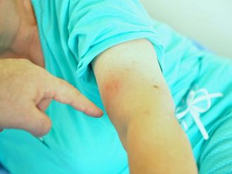 Прегледи за лаймска болест и инфекции, предавани при ухапване от кърлеж, във ВМА