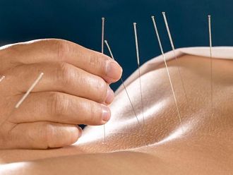 Обучение по акупунктура ще се проведе във варненската „Св. Марина“