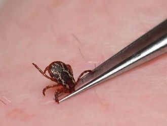 Двама души са починали от марсилска треска в Ямболска област