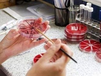 Два взрива на болни от трихинелоза регистрира МЗ