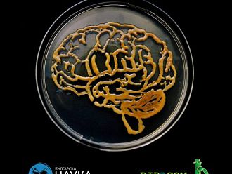 Бъдеща лекарка с награда в престижен конкурс за рисунка с микроорганизми