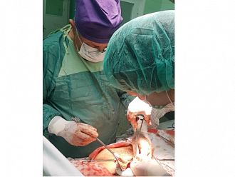 В “УМБАЛ-Пловдив” извадиха огромна киста от корема на млада жена